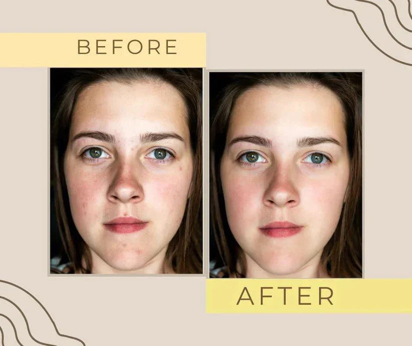 Korean Whitening Cream